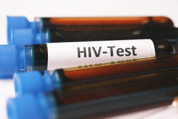 Community HIV Prevention & Testing Drive BMCM Uganda